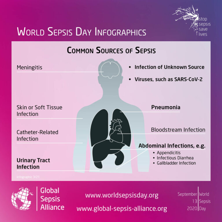 Sepsis Partty Sepsis affects 1.7 Million People Yearly in US - NaDCC tablet